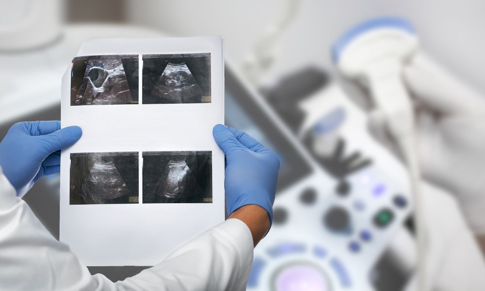 El pólipo vesicular puede desaparecer