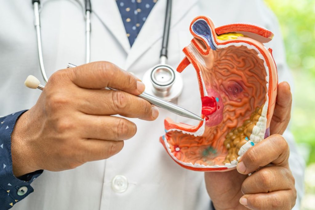 Gastroenterólogo Qué es, qué enfermedades trata y cuándo consultar