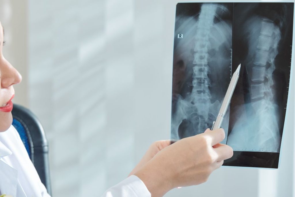 Hiperlordosis lumbar en mujeres cómo afecta y qué hacer1