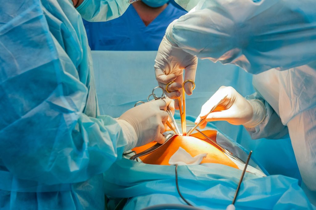 Operación de apendicitis en Panamá