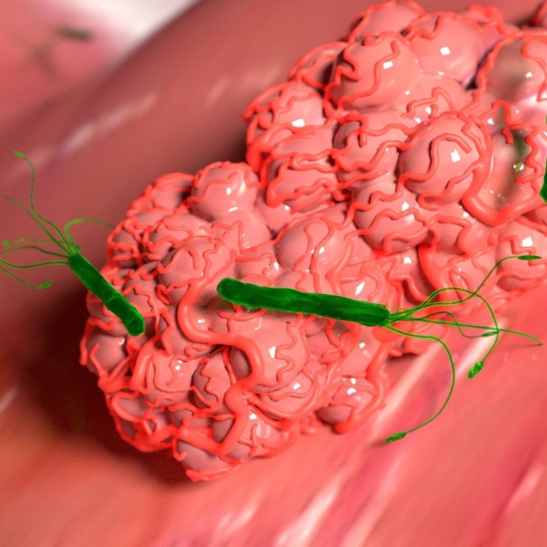 La bacteria Helicobacter pylori es contagiosa