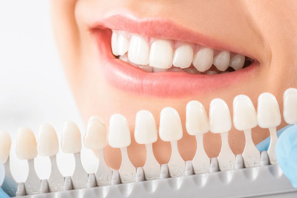 Cuánto cuesta una corona dental en Panamá