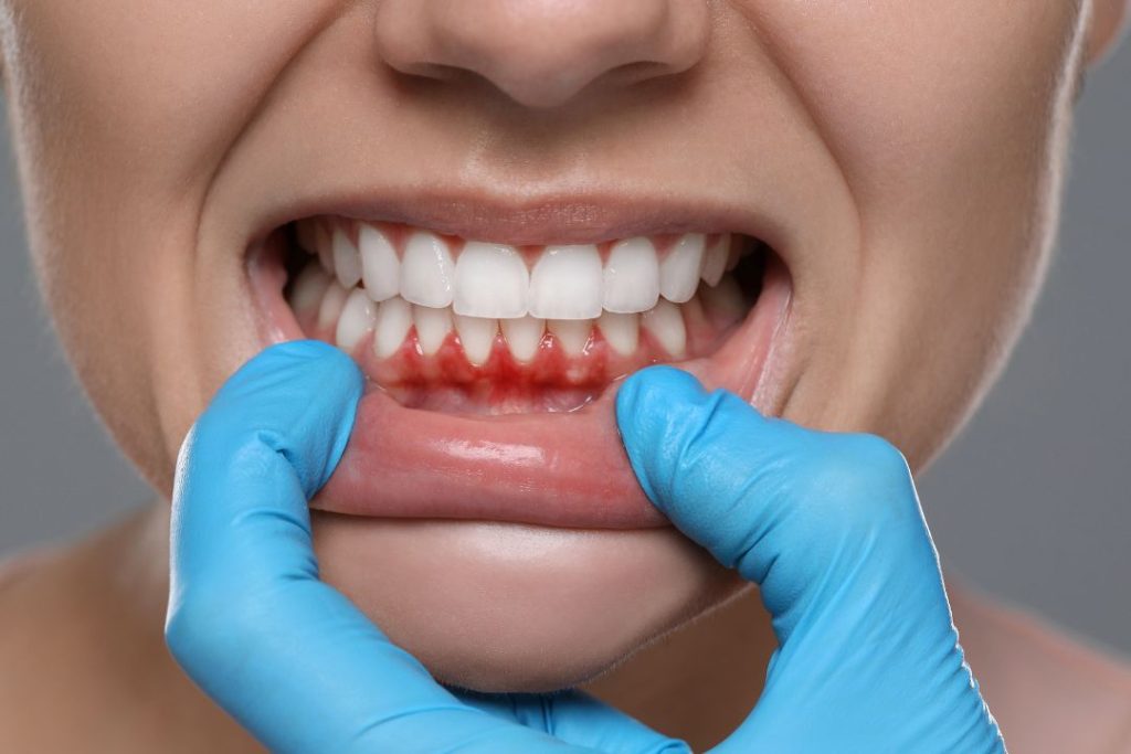 Cuánto cuesta una limpieza dental en Panamá