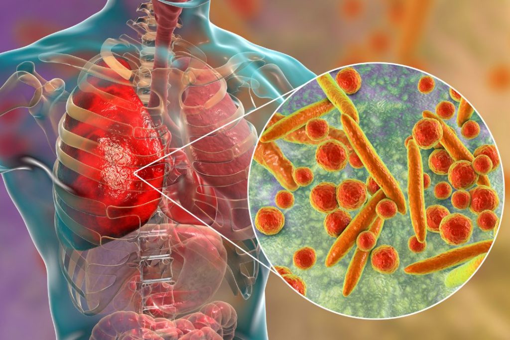 Dónde ponen la vacuna de la influenza en Panamá