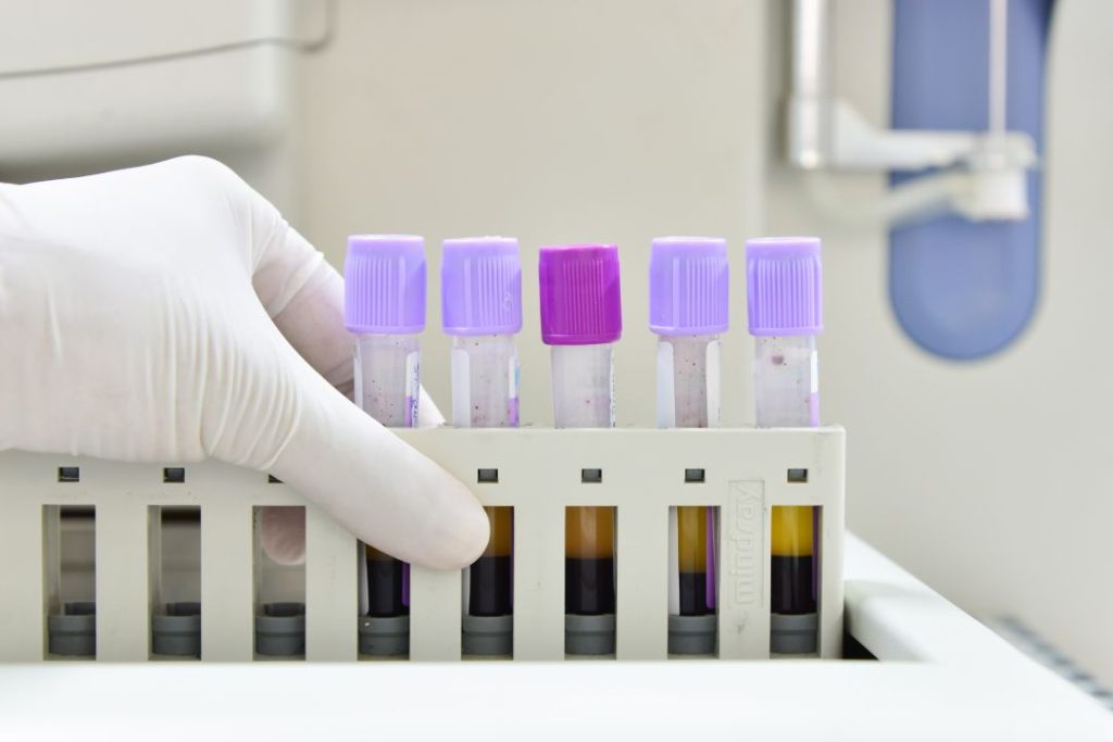 Precios de exámenes de laboratorio