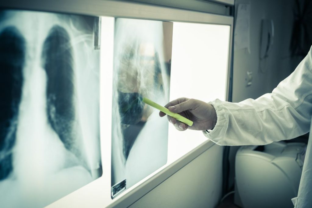 Cuánto cuesta una radiografía en Panamá