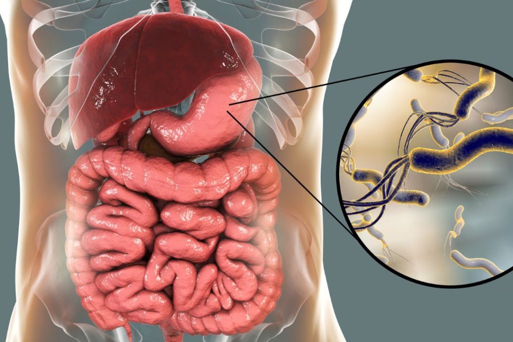 Cuánto cuesta el examen de Helicobacter pylori en Panamá